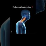 Effective Strategies to Fix Forward Head Posture